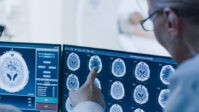 doctors examining brain scans hero
